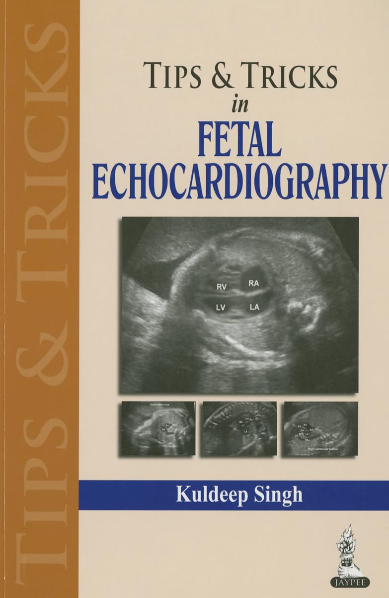 Tips & Tricks in Fetal Echocardiography