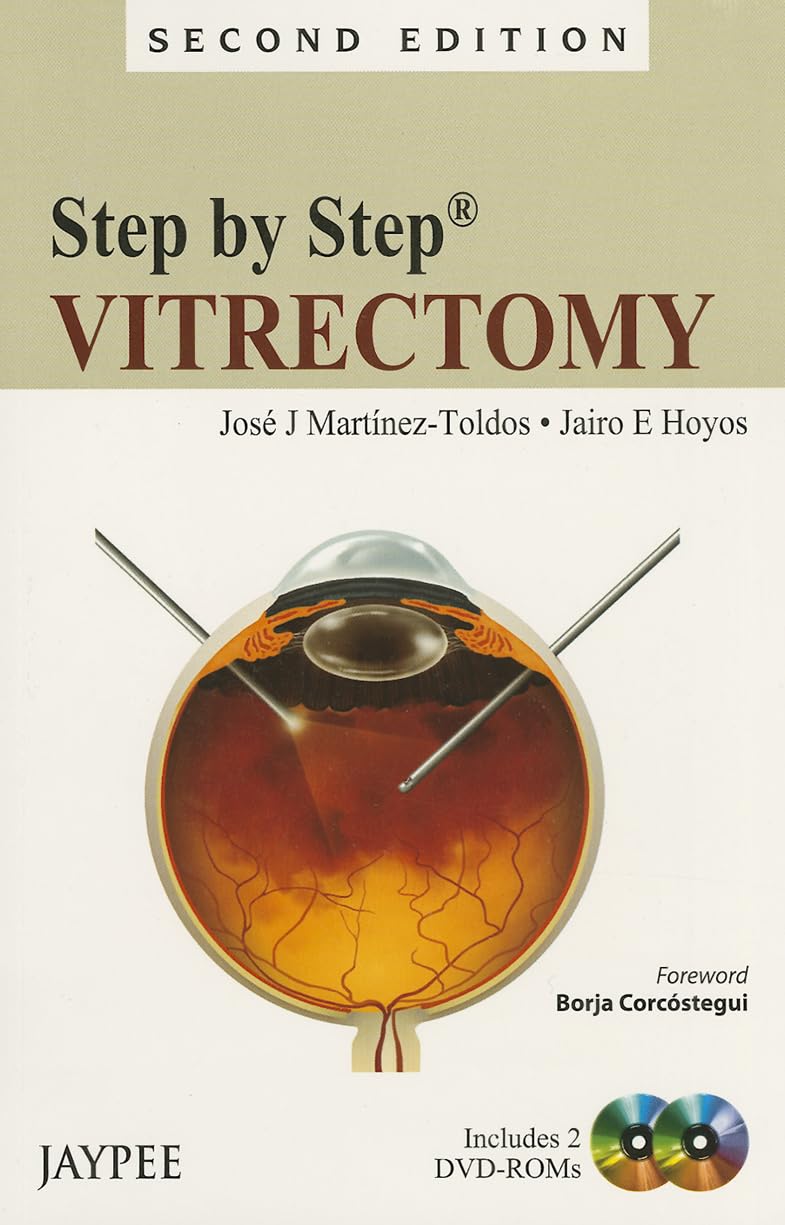 Step by Step Vitrectomy with 2 DVD-ROMs
