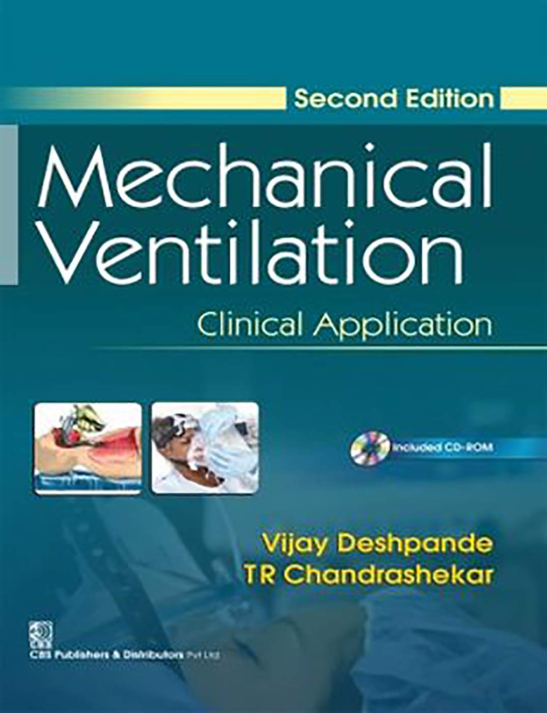 Mechanical Ventilation: Clinical Application (2nd Edition)