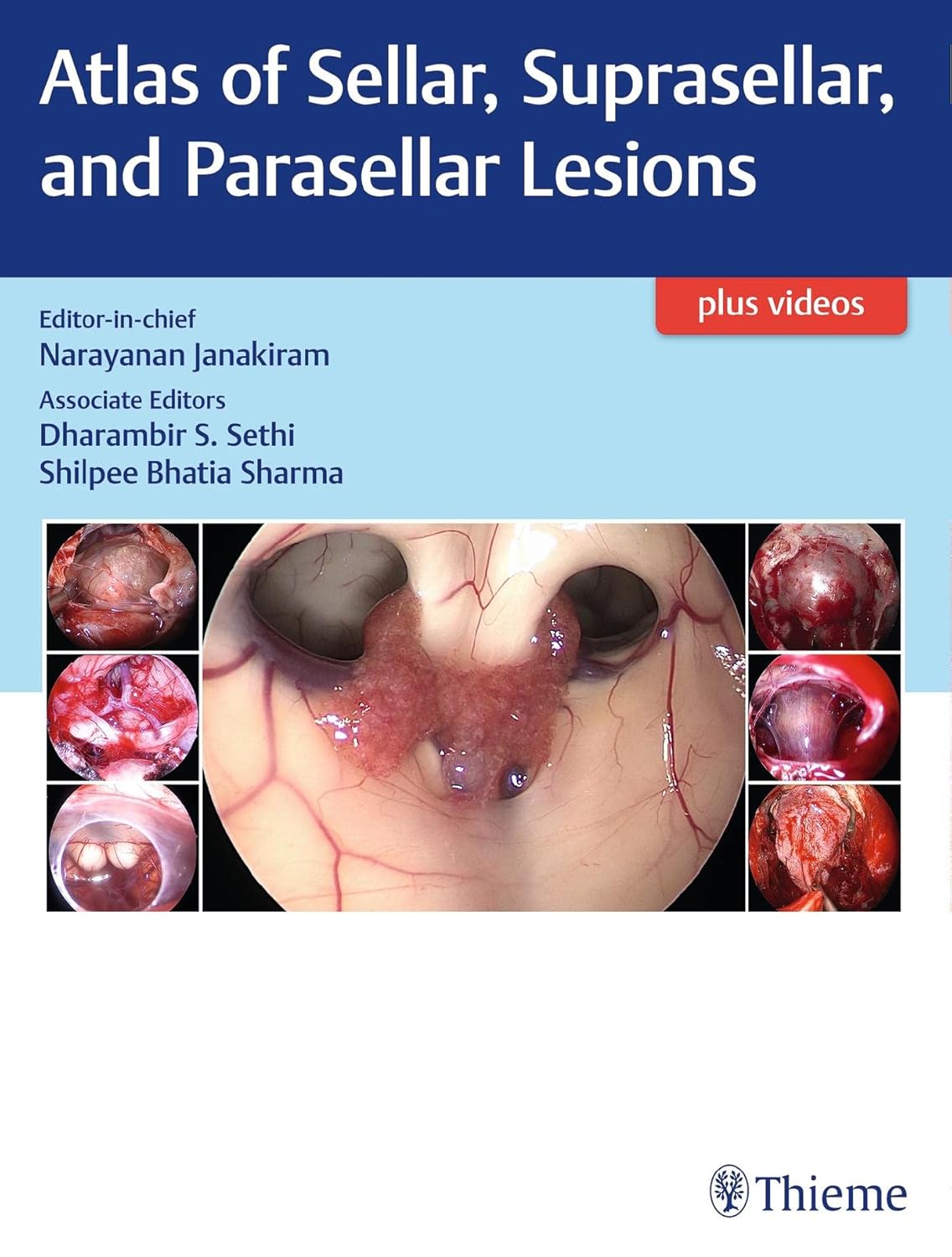 Atlas of Sellar Suprasellar and Parasellar Lesions