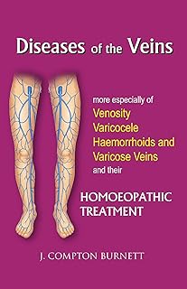 DISEASES OF THE VEINS