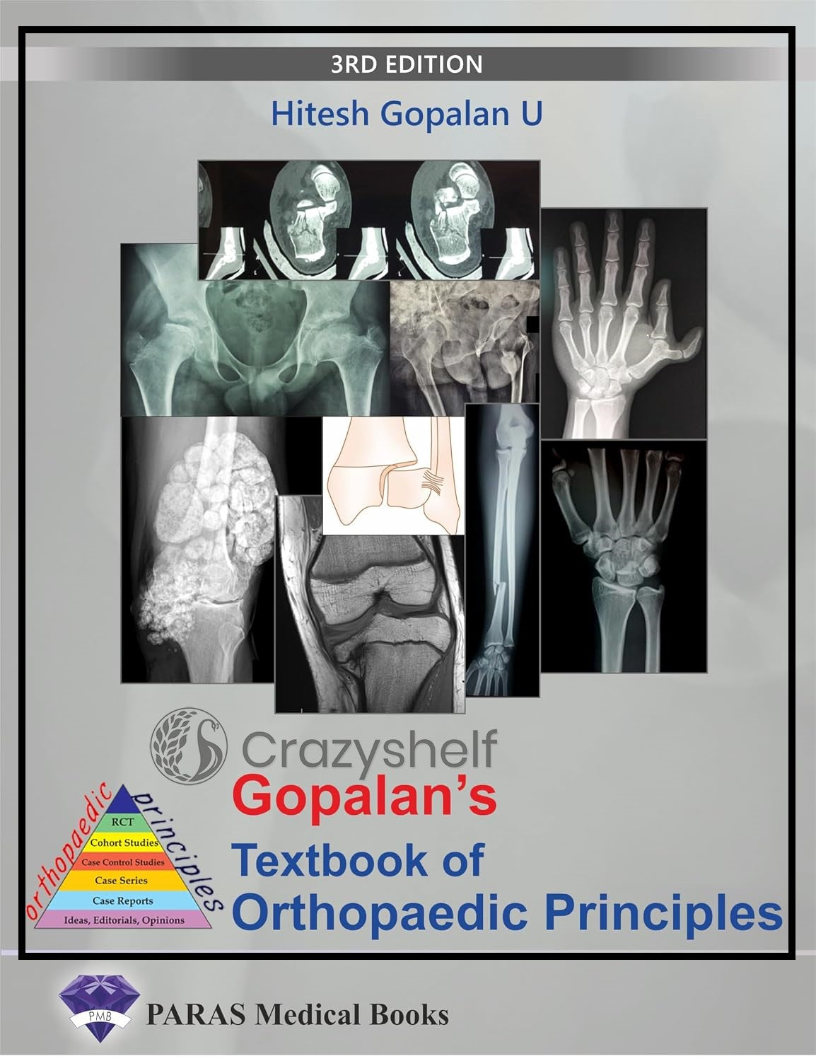 Gopalan's Evidence Based Orthopaedic Principles 2nd