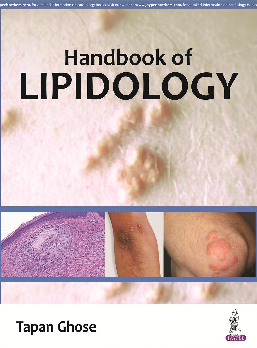 Handbook Of Lipidology