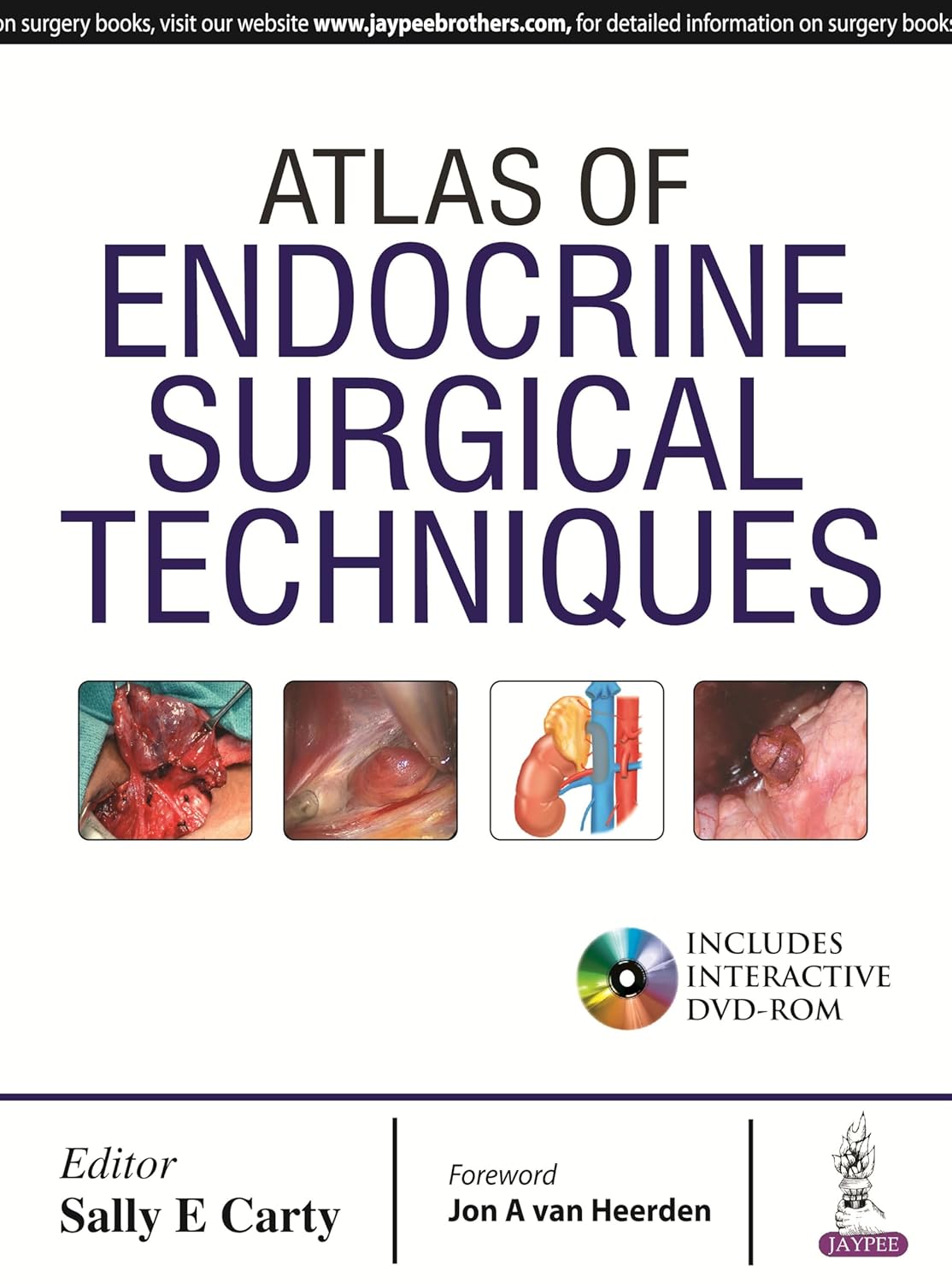 Atlas of Endocrine Surgical Techniques with DVD-ROM