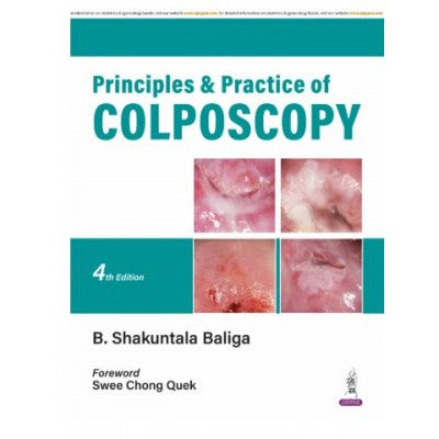 Principles & Practice of Colposcopy (4th Edition)