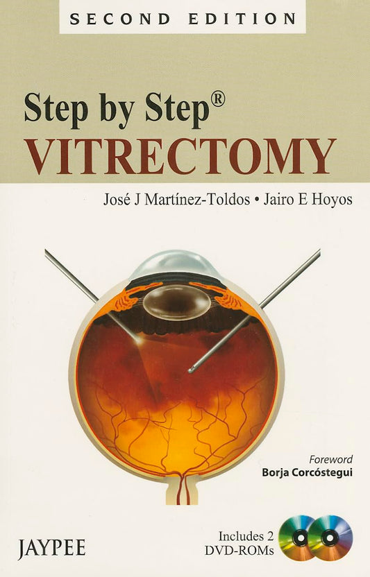 Step by Step Vitrectomy with 2 DVD-ROMs