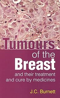 TUMOURS OF THE BREAST