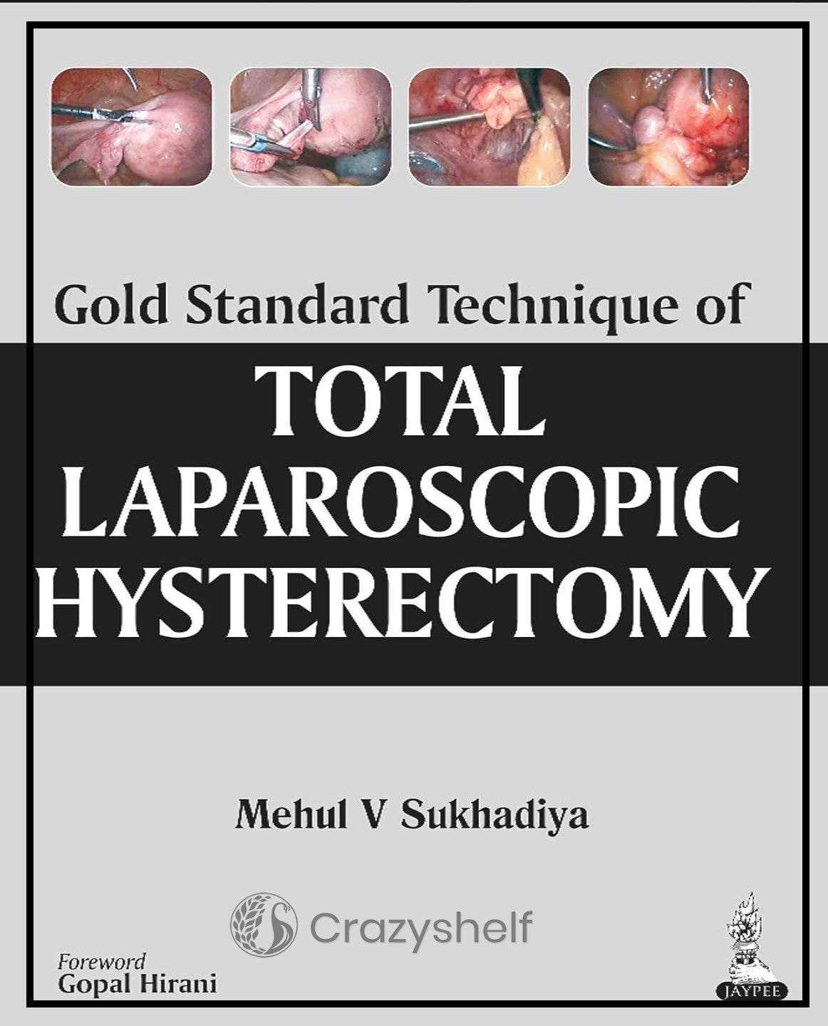 Gold Standard Technique of Total Laparoscopic Hysterectomy