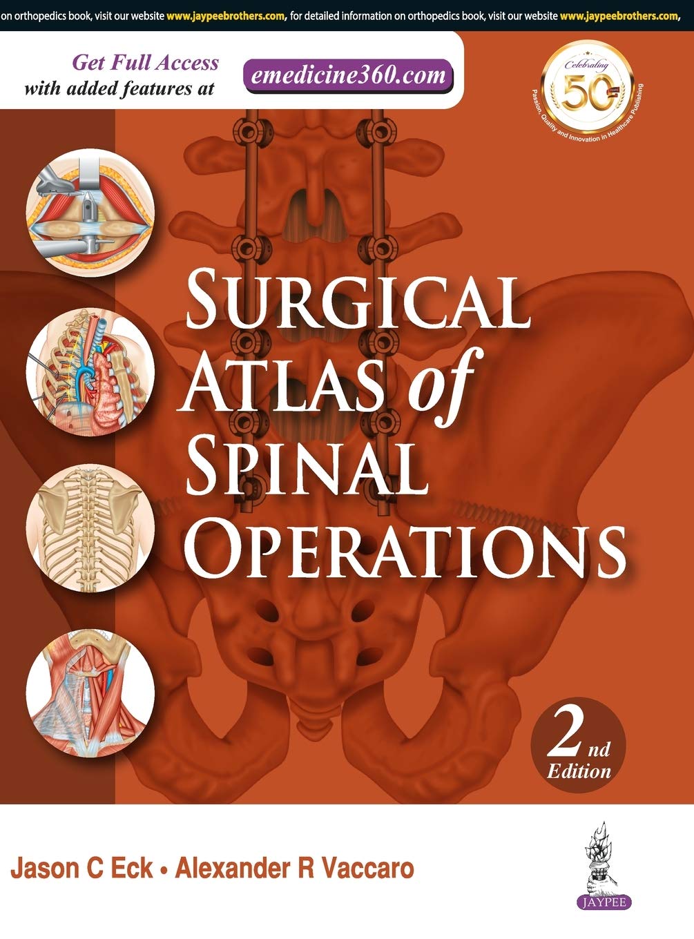 Surgical Atlas of Spinal Operations (2nd Edition)