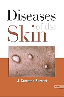 DISEASES OF THE SKIN