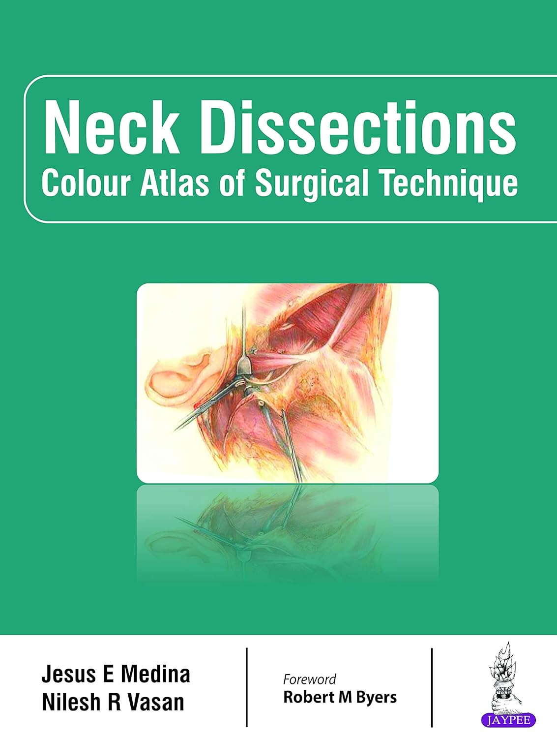 Neck Dissections: Colour Atlas of Surgical Technique