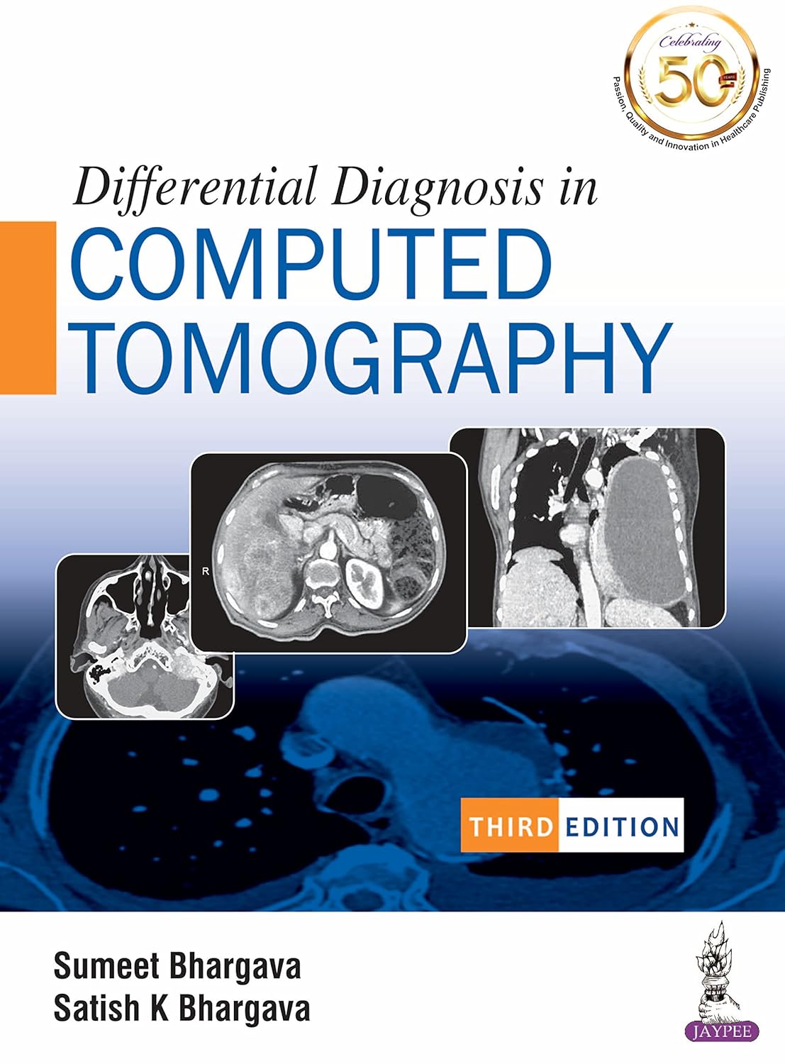 Differential Diagnosis in Computed Tomography (3rd Edition)