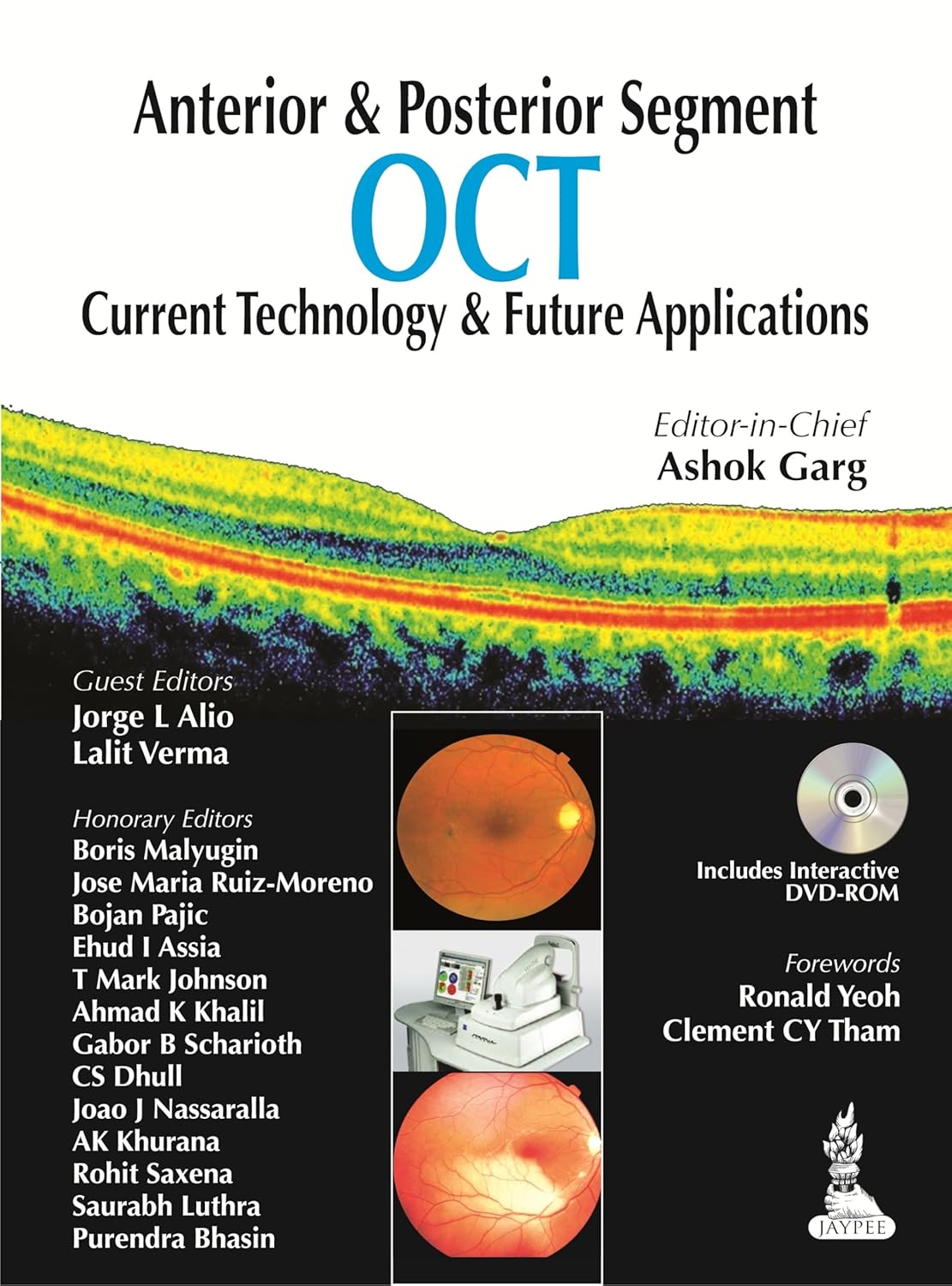 Anterior & Posterior Segment Oct Current Technology & Future Applications With Dvd-Rom